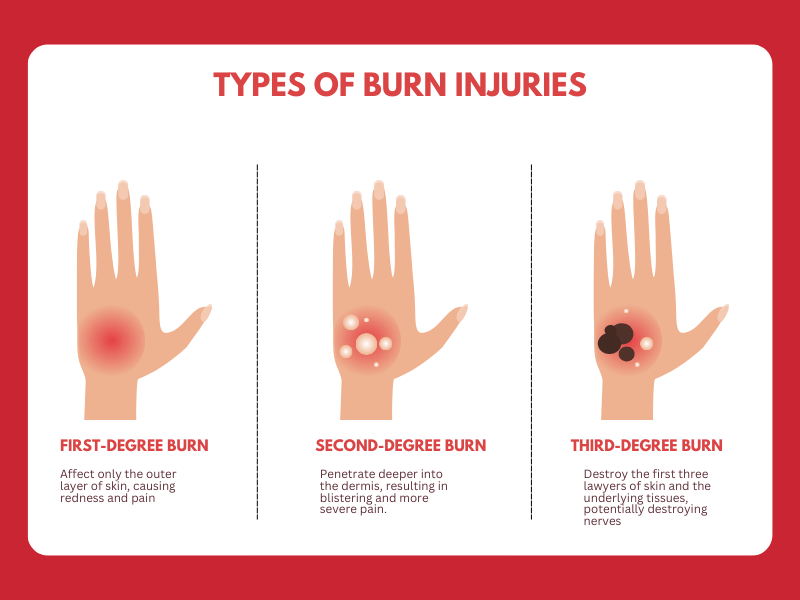 Burn Injury Lawyer (1) Types of burn injuries